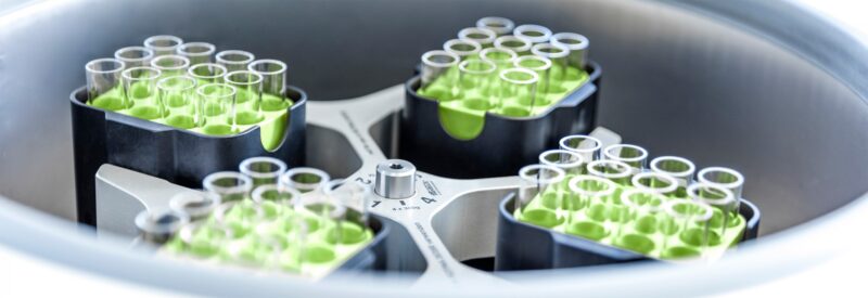 Verkauf der Medizinischen Laboratorien Düsseldorf an Sonic Healthcare Limited