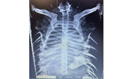 pangolin x-ray