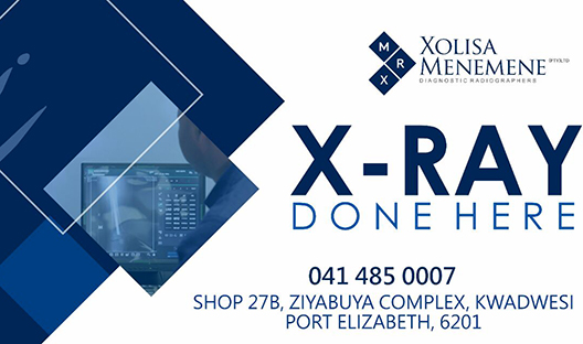 Xolisa Menemene Diagnostics