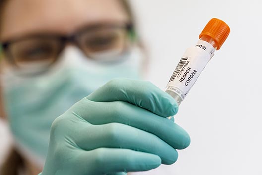 An employee wearing a protective mask and glove shows a throat swab sample for Covid-19 testing at home at the Labor Dr. Heidrich & Kollegen MVZ GmbH medical lab on April 16, 2020 in Hamburg, Germany